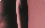 patiente et traitement de la cellulite