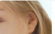 visage de patiente sans taches brunes