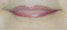 l�vres apr�s dermo-pigmentation