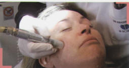 seance micro dermabrasion