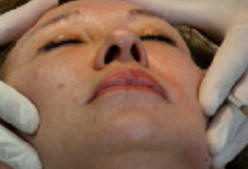 s�ance de remodelage du visage