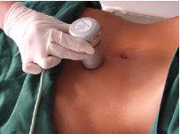 traitement ultrasons sur cellulite ventre