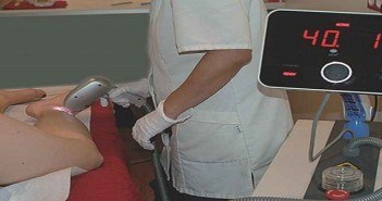 L’épilation laser : que penser de la technologie ‘’IPEEL’’ ? Ipeel