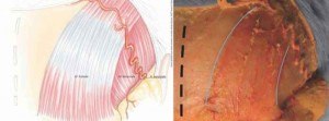 L’artère temporale se situe dans le plan graisseux. With courtesy of Expert2expert.