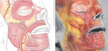 Anatomie du visage dissections