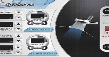 Cryolipolyse et surcharges graisseuses localisées Cryolipolyse
