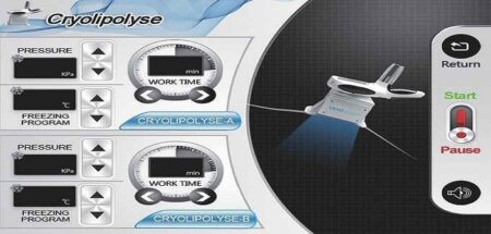 Cryolipolyse