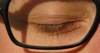Le lissage tenseur non chirurgical des paupières au cabinet oeil et paupière en excès
