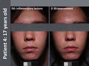 ImageExtract-039