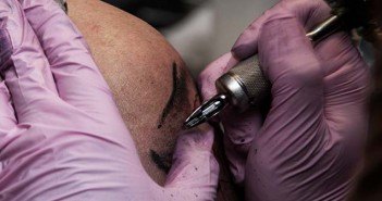 La dermopigmentation réparatrice dermopigmetation épaule