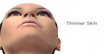 Skin tightening par radiofréquence classique et fractionnée SKIN TIGHTENING