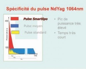 caractéristique du pulse Nd Yag