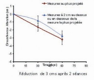 Réduction de la circonférence après 2 séances