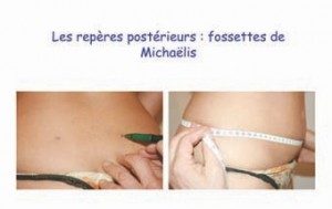 Les repères postérieurs