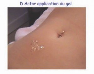 Application du gel