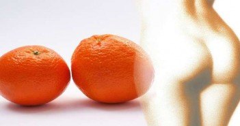 Essai des ondes de choc contre la cellulite ONDES DE CHOC DANS LES LIPODYSTROPHIES