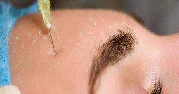 Mésolift : mésothérapie du visage hydratante et antioxydante mesolift