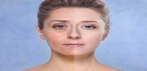 peau regeneree grace au peeling moyen