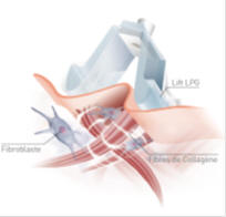 pincer_relacher