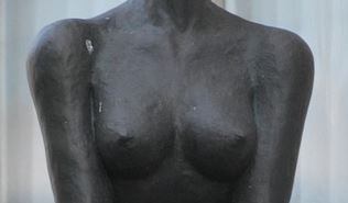 L’implantation de graisse dans les seins n’augmente pas le risque de cancer poitrine de femme