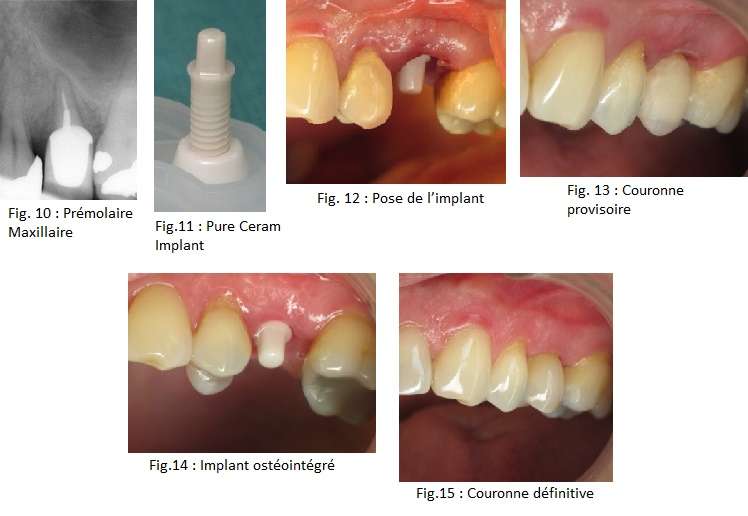 Dr S. Zarrine / Laboratoire Oral Beauty