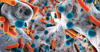 Rôle des biofilms dans les complications d’injection de fillers bactéries et biofilm