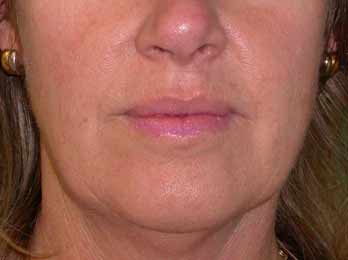 bas visage femme, ovale