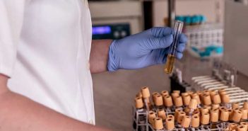 Quels marqueurs biologiques pour évaluer le vieillissement ? laboratoire d'analyses