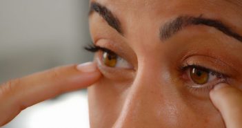 Evaluation de la blépharoplastie médicale par plasma (étude clinique)