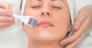 Microneedling pour les lèvres