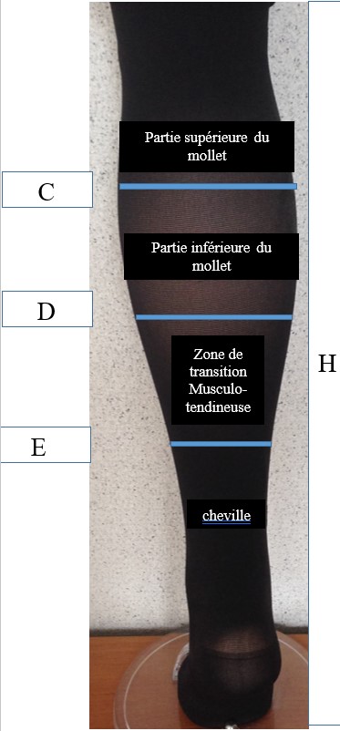 forme de la jambe