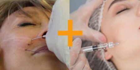 fils tenseurs et injections sur visage de femme