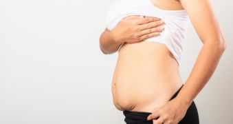 Peau relâchée après grossesse