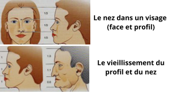 Se refaire le nez sans chirurgie, par injections correctrices