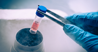 Exosomes traitement
