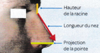Méthode de Goode