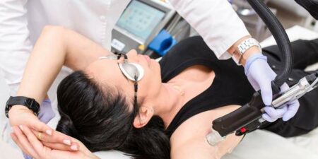 Blanchiment de la pilosité et épilation saisonnière Blanchiment de la pilosité