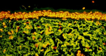 Marquage par immunofluorescence indirecte de l'élastine région ensoleillée