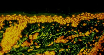 Marquage par immunofluorescence indirecte de l'élastine