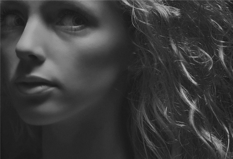 Correction-du-nez-à-l’acide-hyaluronique