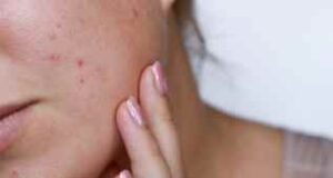 Caveman method, la tendance à risque du « no skincare » Caveman method