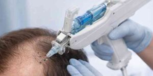 mesotherapie automatisée