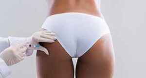injection de remodelage des fesses