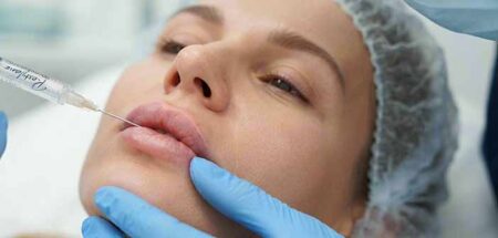 Swedish Lip Technique : nouvelle injection de lèvres à la canule injection de levres à la canule